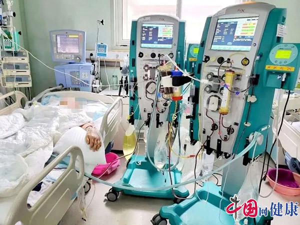 玉田县医院实现人工肝血浆置换治疗技术